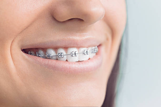 Best Traditional Braces  in Oak Grove, KY